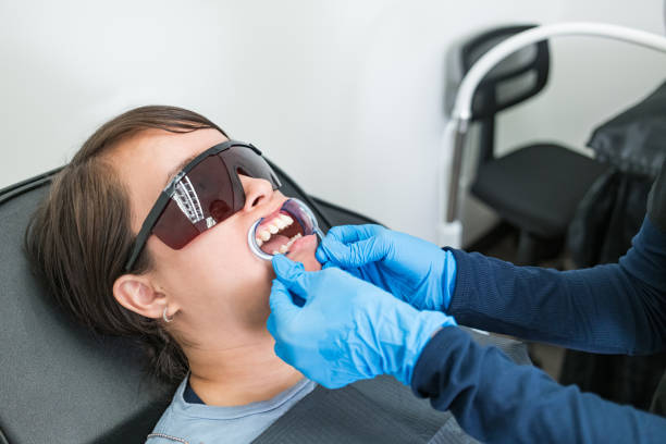 Best Knocked-Out Tooth (Avulsed Tooth) Treatment in Bonner West Riverside, MT